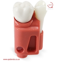 Real-T-Endo™ #14 With Insert Molar (UL6)