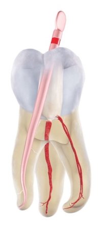 RECIPROC® blue Gutta Percha R25 (60)