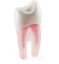 Real-T-Endo™ #12 Pre-Molar (UL4)