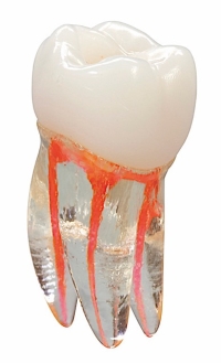 Training Tooth #3 Molar UR6 (5)