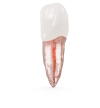 X2 Endo™#09 Incisor (UL1)